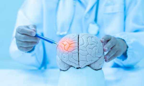 Neurologist,Hand,Pointing,Brain,Anatomy,Human,Model,And,Brain,Disease